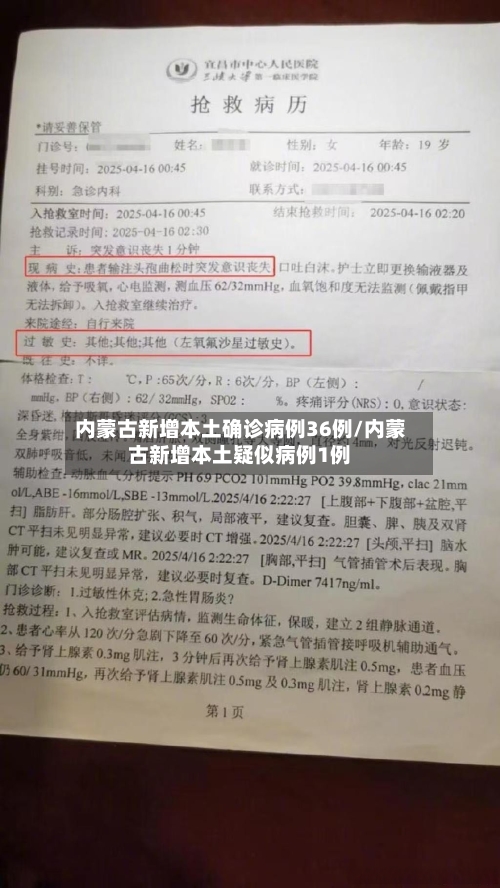 内蒙古新增本土确诊病例36例/内蒙古新增本土疑似病例1例