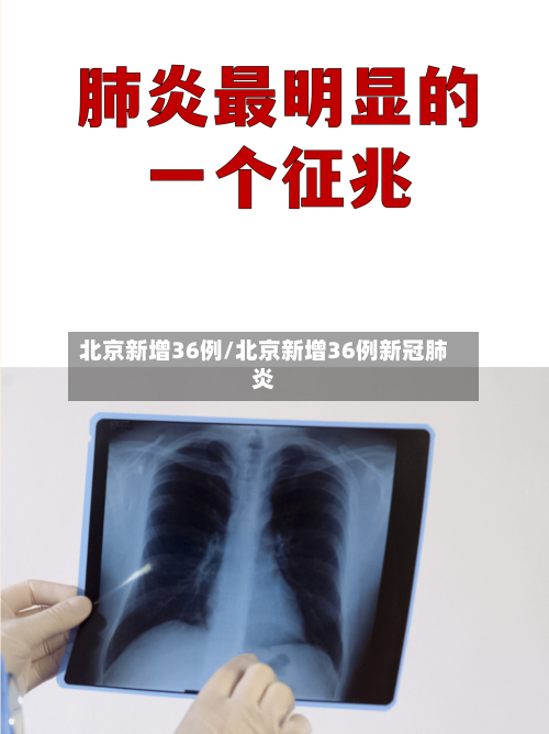 北京新增36例/北京新增36例新冠肺炎-第2张图片