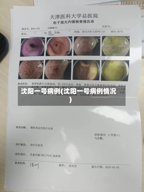 沈阳一号病例(沈阳一号病例情况)-第2张图片